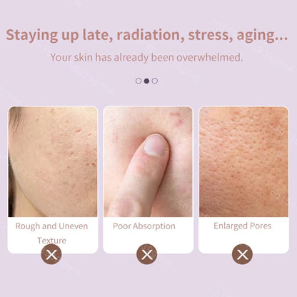 Ice Roller Facial Massager – Instant Cooling & Skin Relief